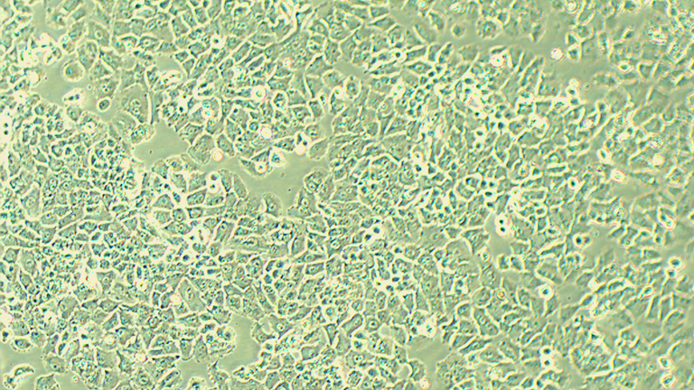 NCI-H460人大细胞肺癌细胞