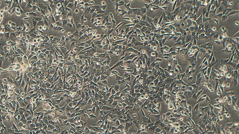 UM-UC-3人膀胱移行细胞癌细胞