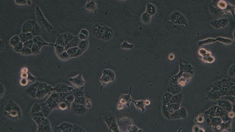 HEC-1-B人子宫内膜腺癌细胞