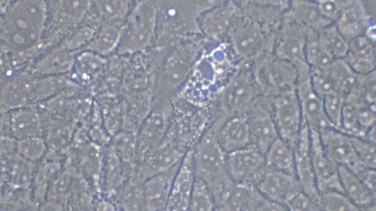 SW1116人结肠腺癌细胞