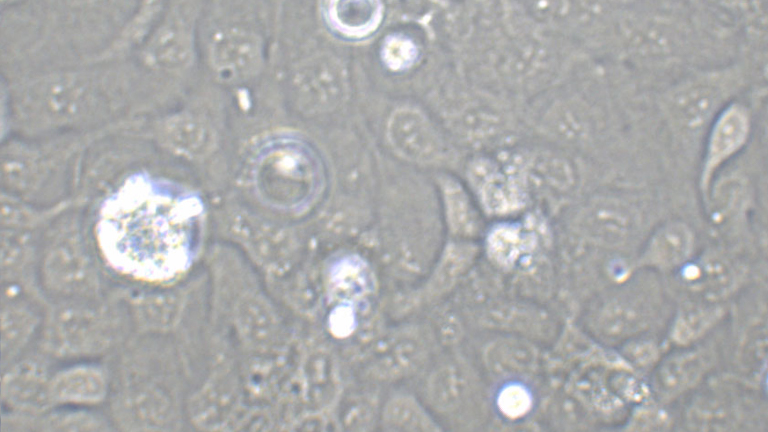 SW626人结肠腺癌细胞(卵巢转移)