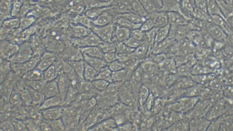 HCT-8人结直肠腺癌细胞