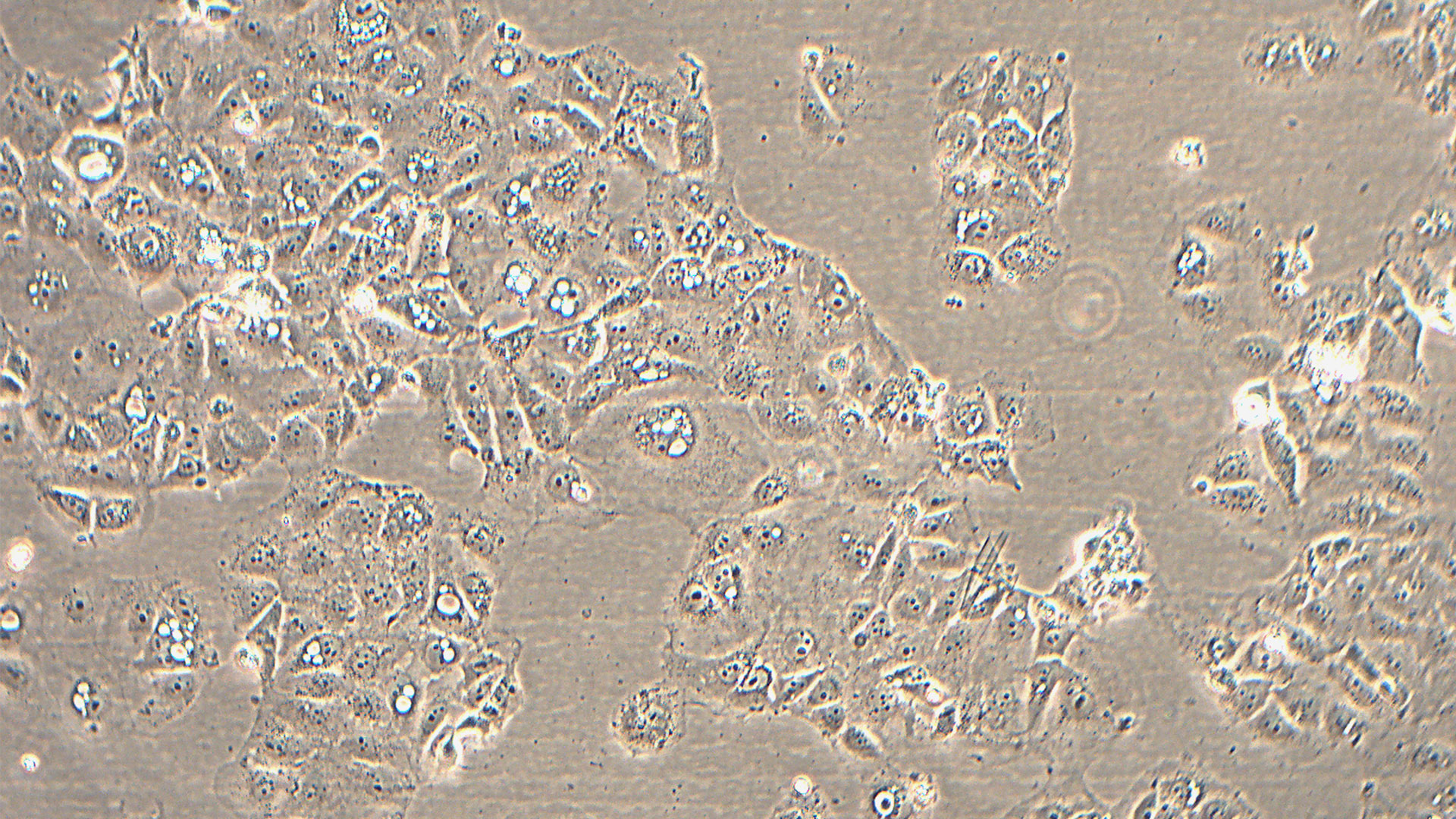 Huh-6人肝母细胞瘤细胞