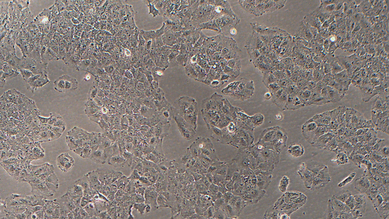 Huh-7人肝癌细胞