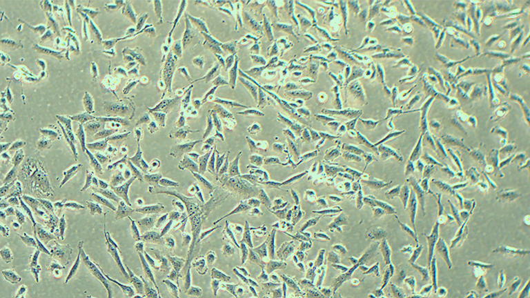 SNU-449人肝癌细胞