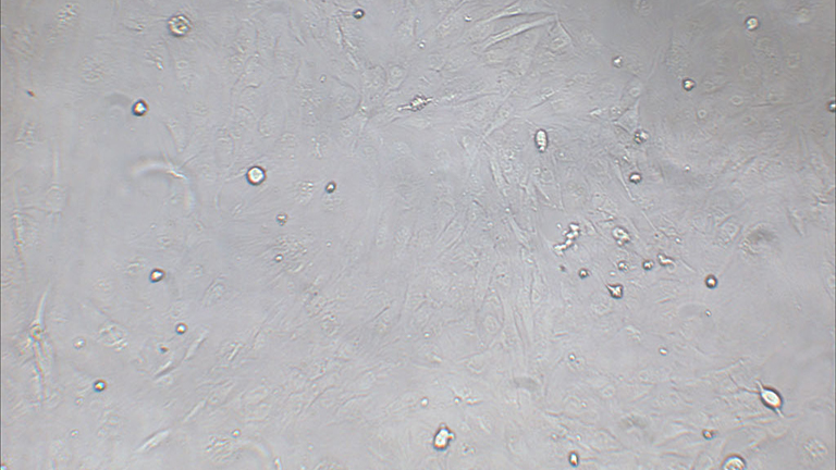 SNU-387人多形性肝癌细胞