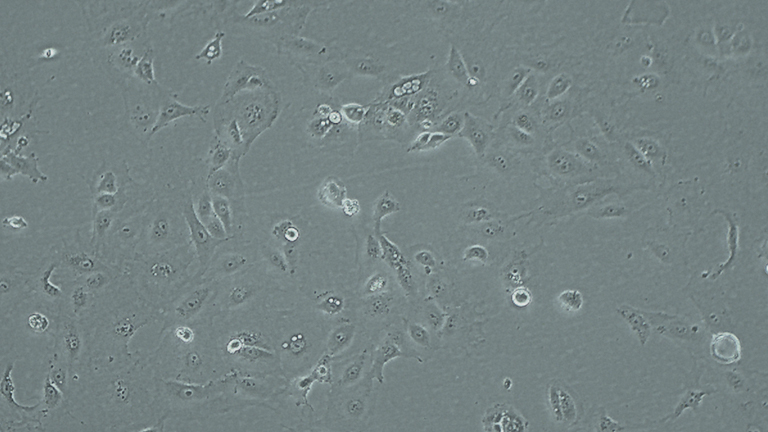 SNU-182人肝癌细胞