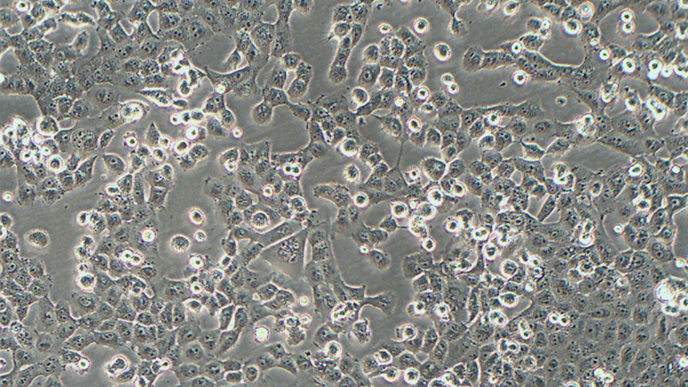 NCI-H1299人非小细胞肺癌细胞