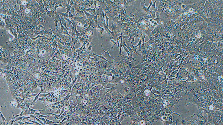 NCI-H1573人非小细胞肺腺癌细胞