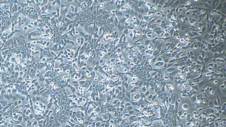 NCI-H446人小细胞肺癌细胞