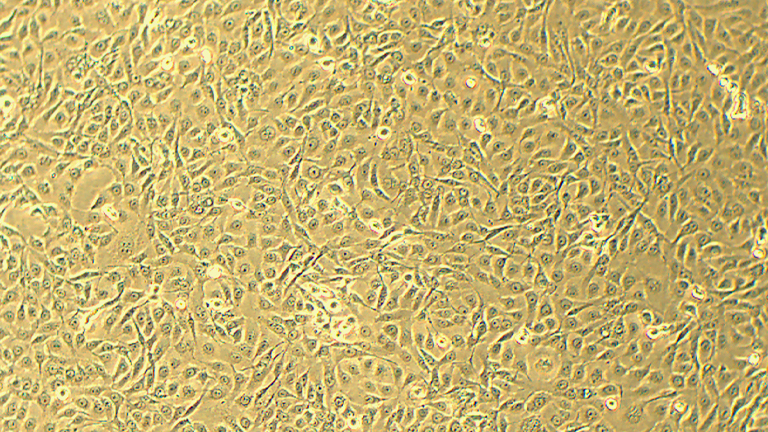 NCI-H1650人肺支气管癌细胞