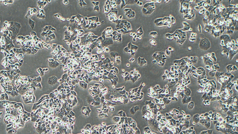 NCI-H520人肺鳞癌细胞