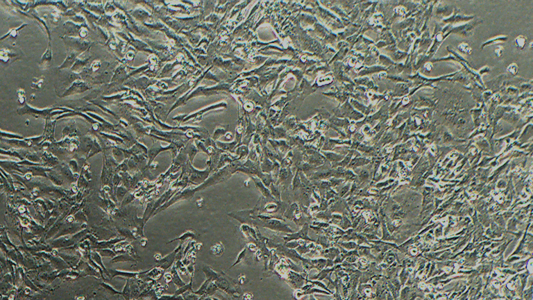 Calu-1人肺癌细胞