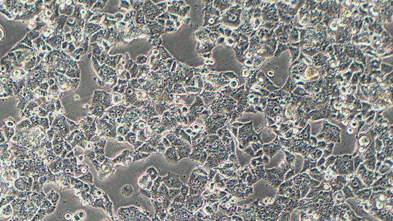 NCI-H1395人肺腺癌细胞