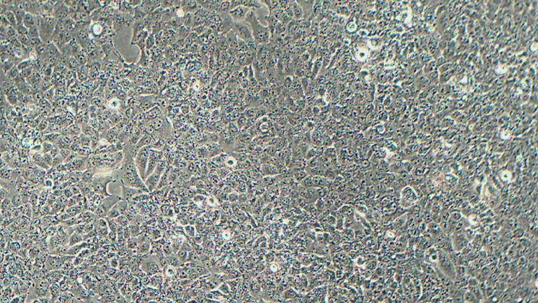NCI-H441人肺腺癌细胞