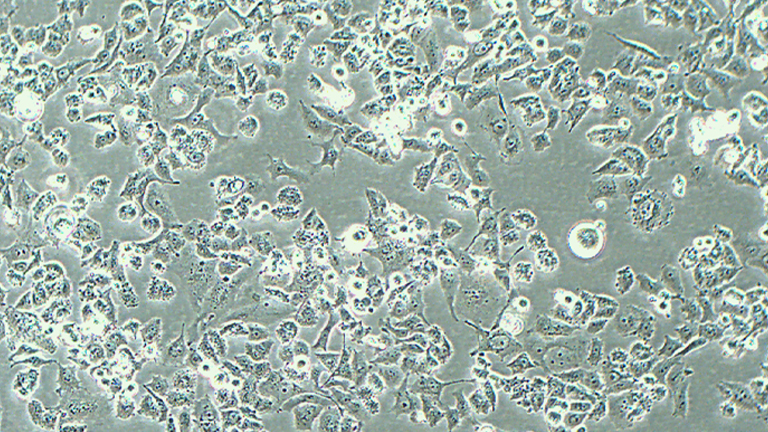 DMS 114人小细胞肺癌细胞
