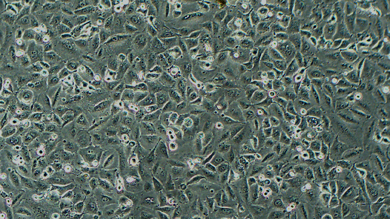 NCI-H2030人非小细胞肺癌细胞