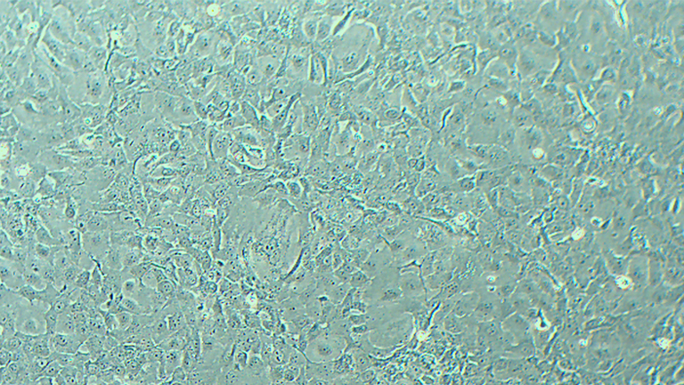 NCI-H1568人非小细胞肺癌细胞（淋巴结）
