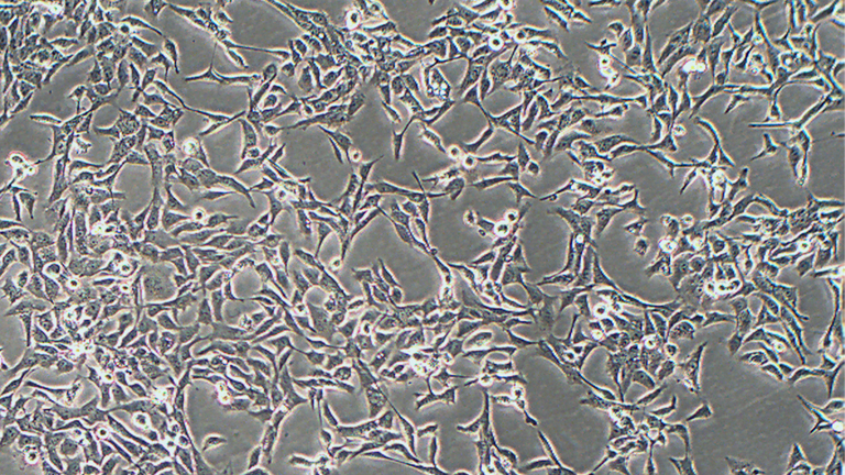 HCC1806人乳腺癌细胞