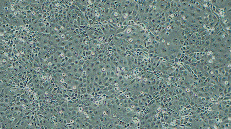 MKN28（MKN74）人胃癌细胞