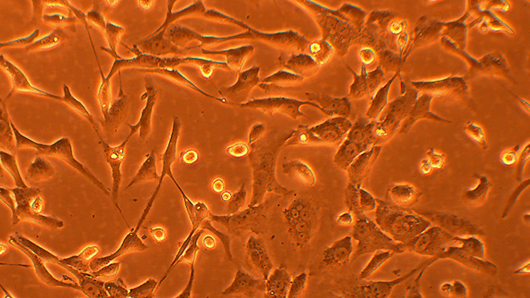 SK-OV-3人卵巢腺癌细胞