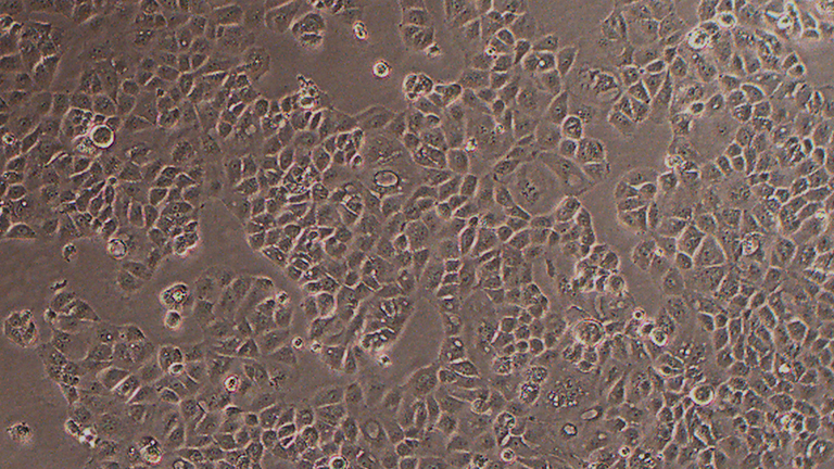 NIH/OVCAR-3人卵巢腺癌细胞
