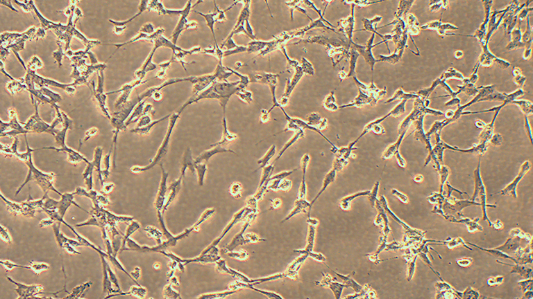 ES-2人卵巢透明细胞癌细胞