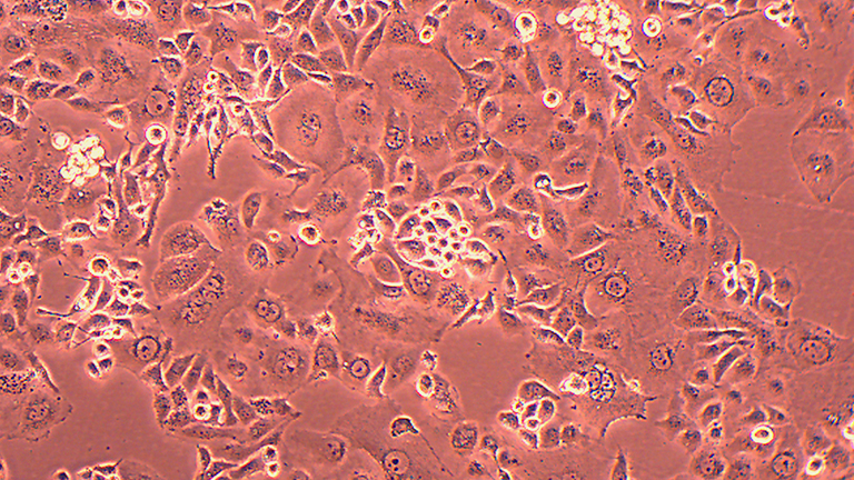 Anglne人卵巢癌细胞