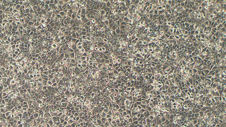SW780人膀胱移行细胞癌细胞