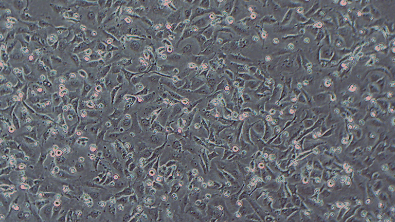 J82人膀胱移行细胞癌细胞