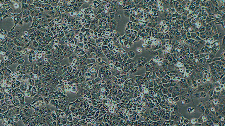 HEC-1-A人子宫内膜腺癌细胞