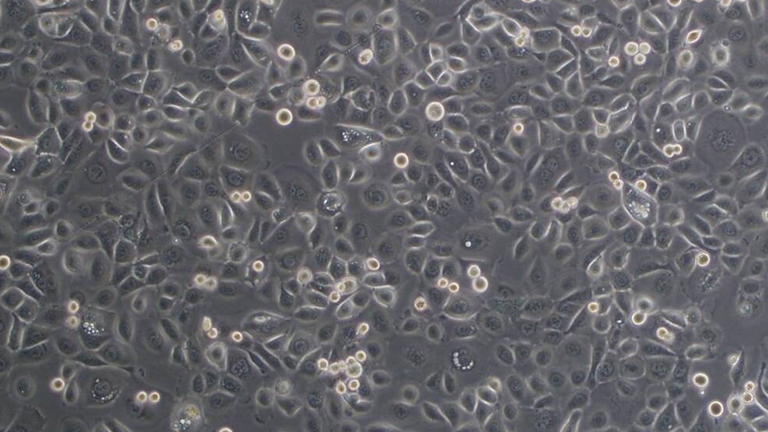 HCC94人子宫鳞癌细胞（高分化）