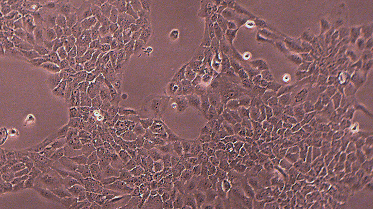 A431人皮肤基底细胞癌细胞