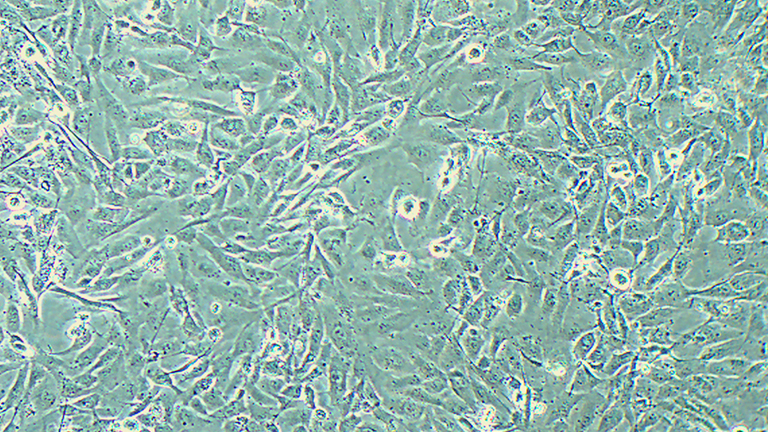 786-0人肾透明细胞腺癌细胞