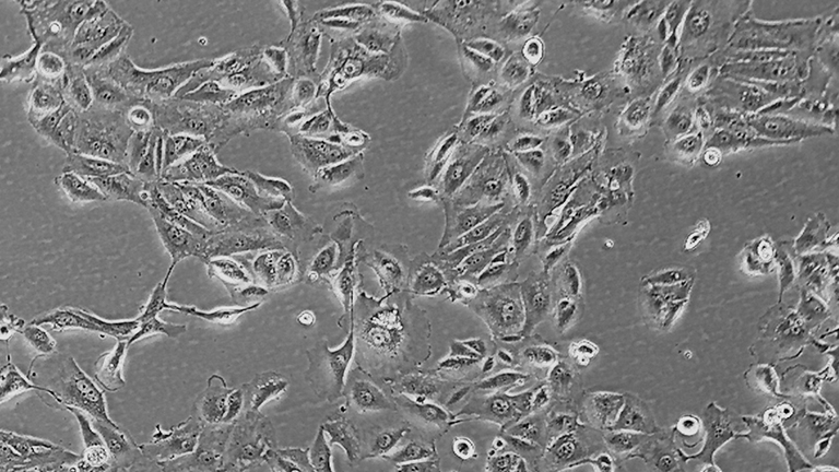 Caki-2人肾透明细胞癌细胞