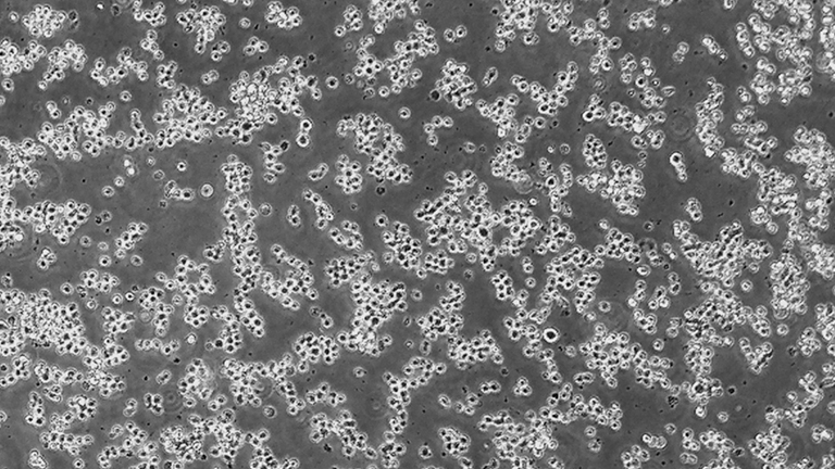 Su-DHL-6人B细胞淋巴瘤细胞