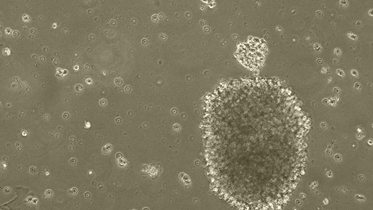 NK92/MI人自然杀伤细胞淋巴瘤细胞