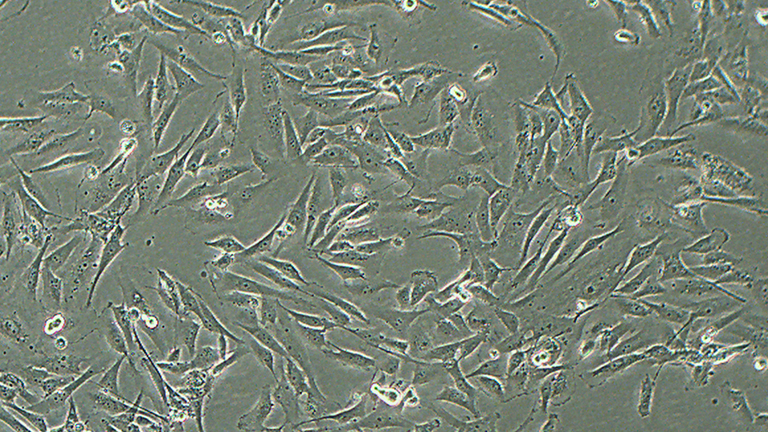 SW1783人脑星形胶质细胞瘤细胞