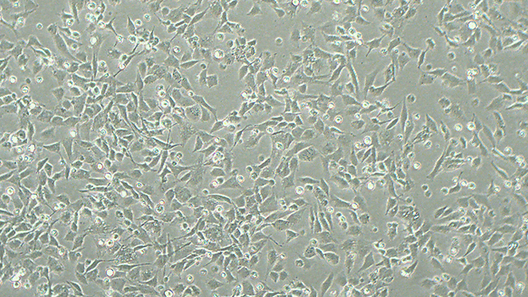 CCF-STTG1人脑星形胶质细胞瘤细胞