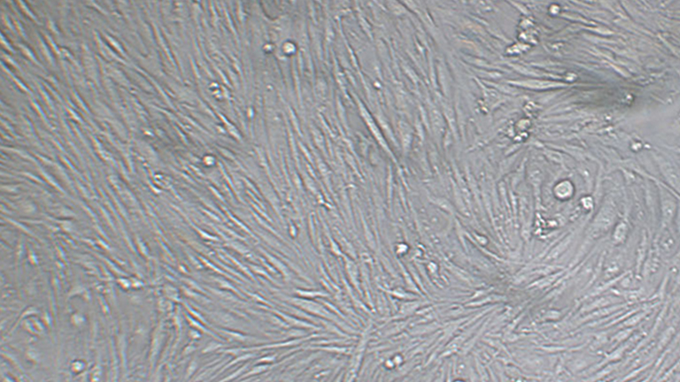 SF126人脑星形胶质瘤细胞