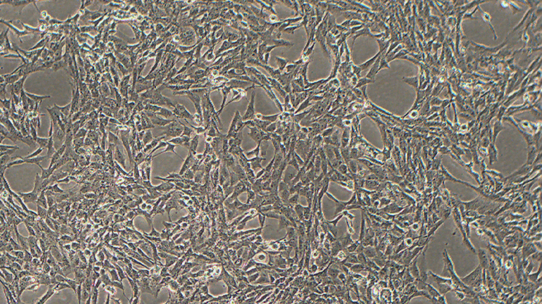 HSCT6大鼠肝星状细胞