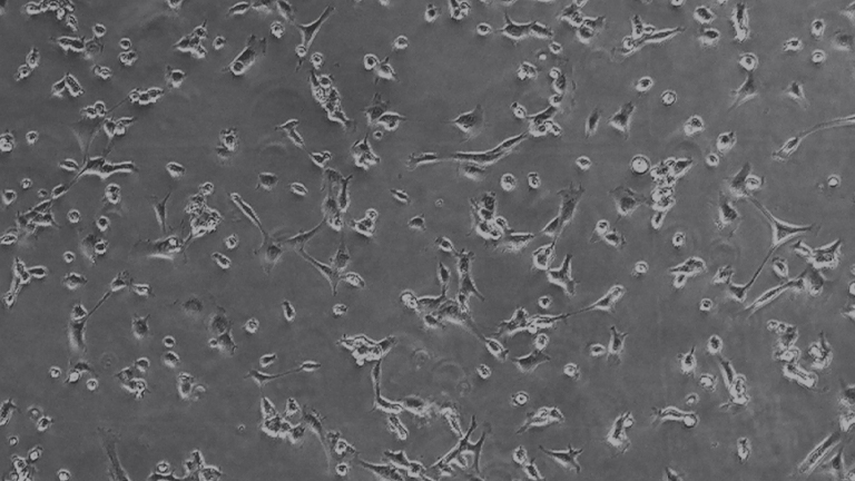BNL 1ME A.7R.1小鼠肝瘤细胞