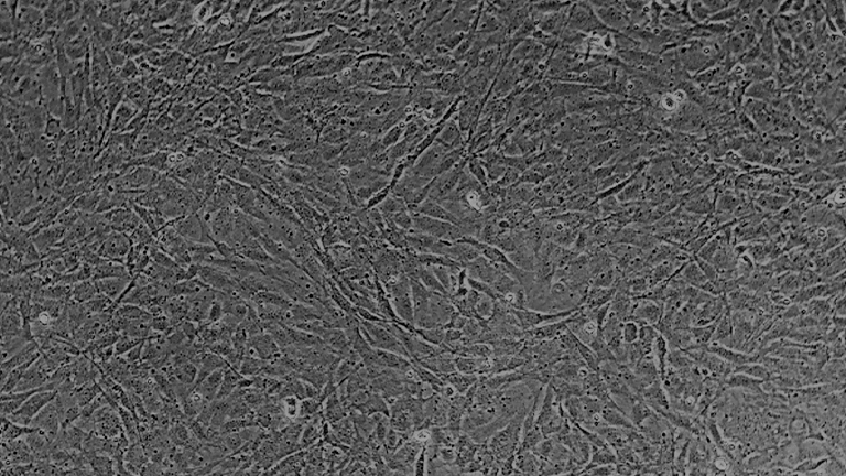 MC3T3-E1 Subclone 14小鼠颅顶前骨细胞亚克隆14