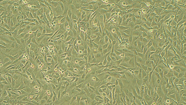 SF295人胶质母细胞瘤细胞