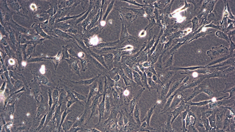 M059K人脑恶性胶质母细胞瘤细胞
