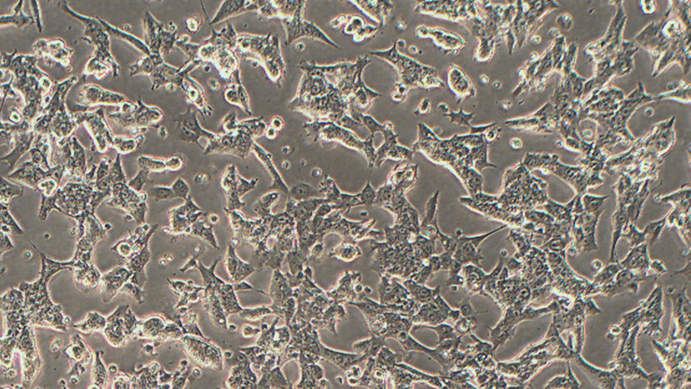 HePa1-6小鼠肝癌细胞