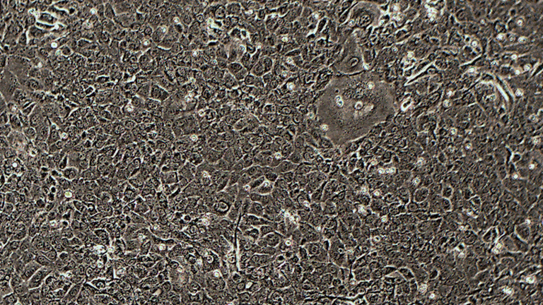 ID8小鼠卵巢上皮细胞