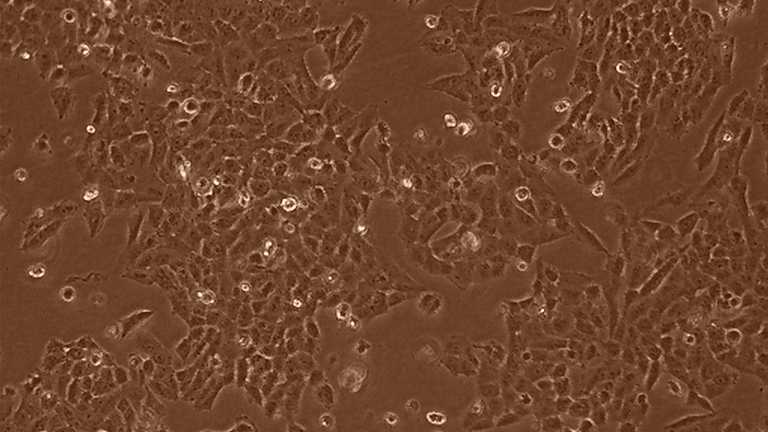 LN-18人脑胶质母细胞瘤细胞