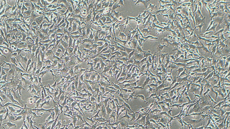 B16-F10小鼠黑色素瘤细胞