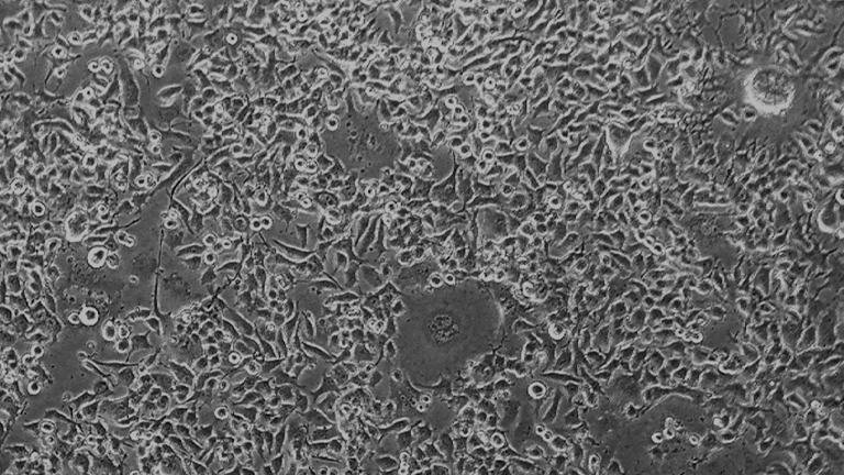 Neuro-2a小鼠神经母细胞瘤细胞